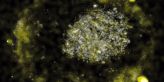 Fascinující bakterie pohlcuje toxické kovy a vylučuje drobné zlaté nugety